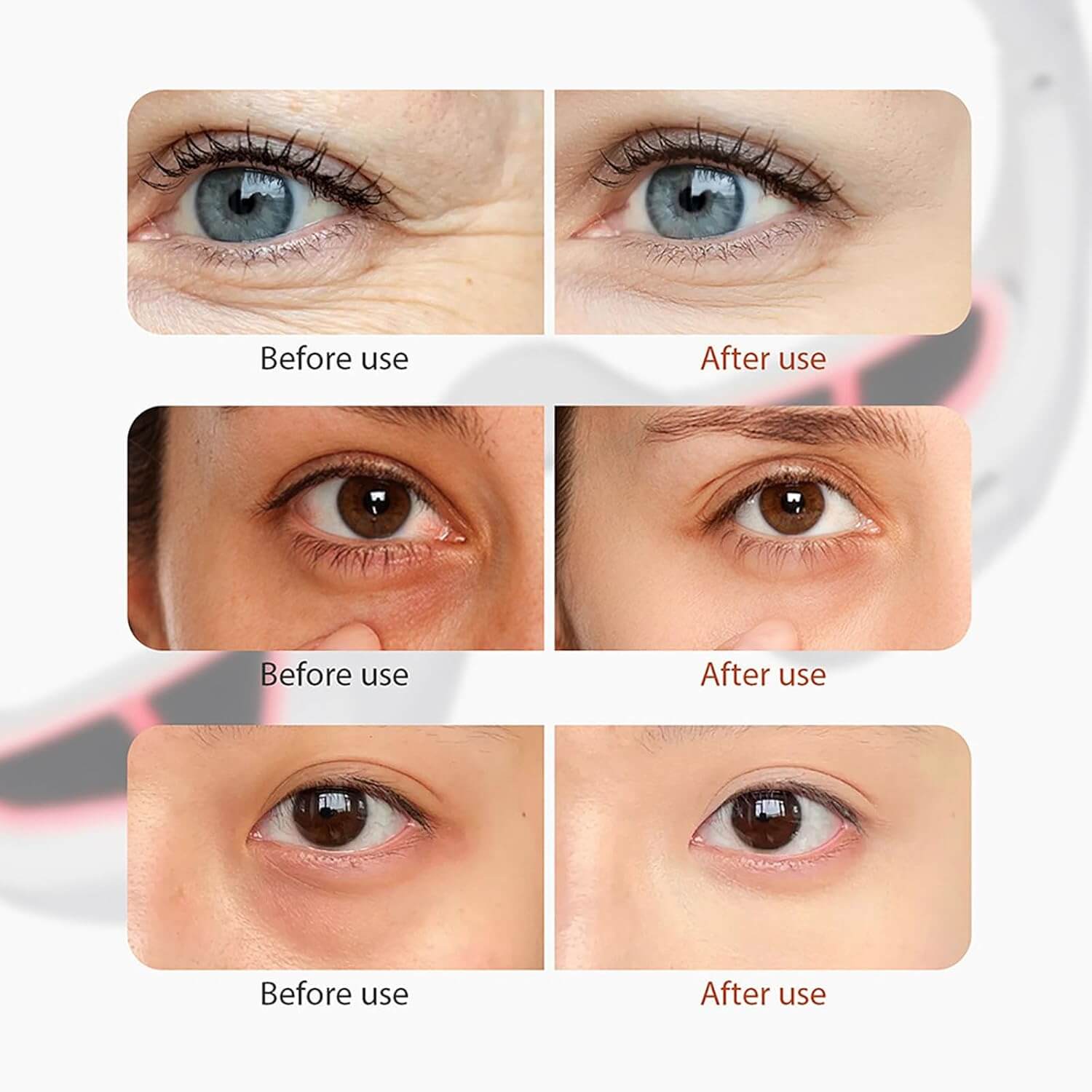 SkinSik™ Eye Revive™ Massager